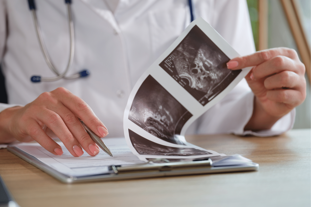 Doctor looking at ultrasound of the ovaries
