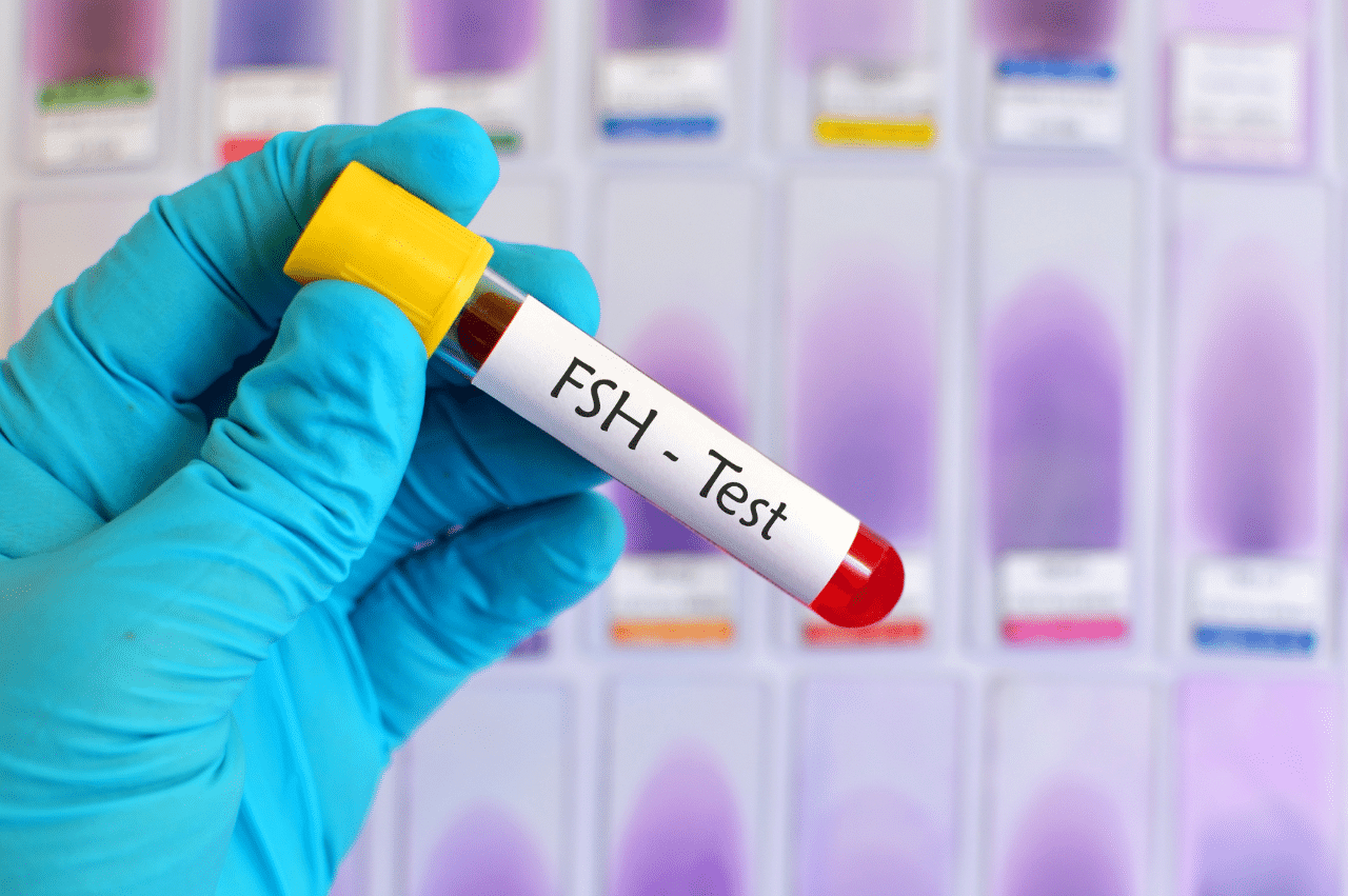 Photo of a rubber gloved hand holding a vial with blood with a label that says "FSH - Test"