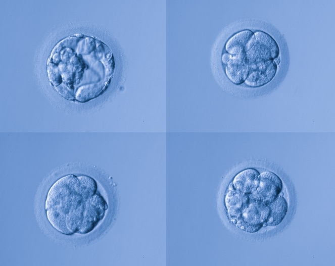 Can You Donate Your Eggs If You’re Donor Conceived?