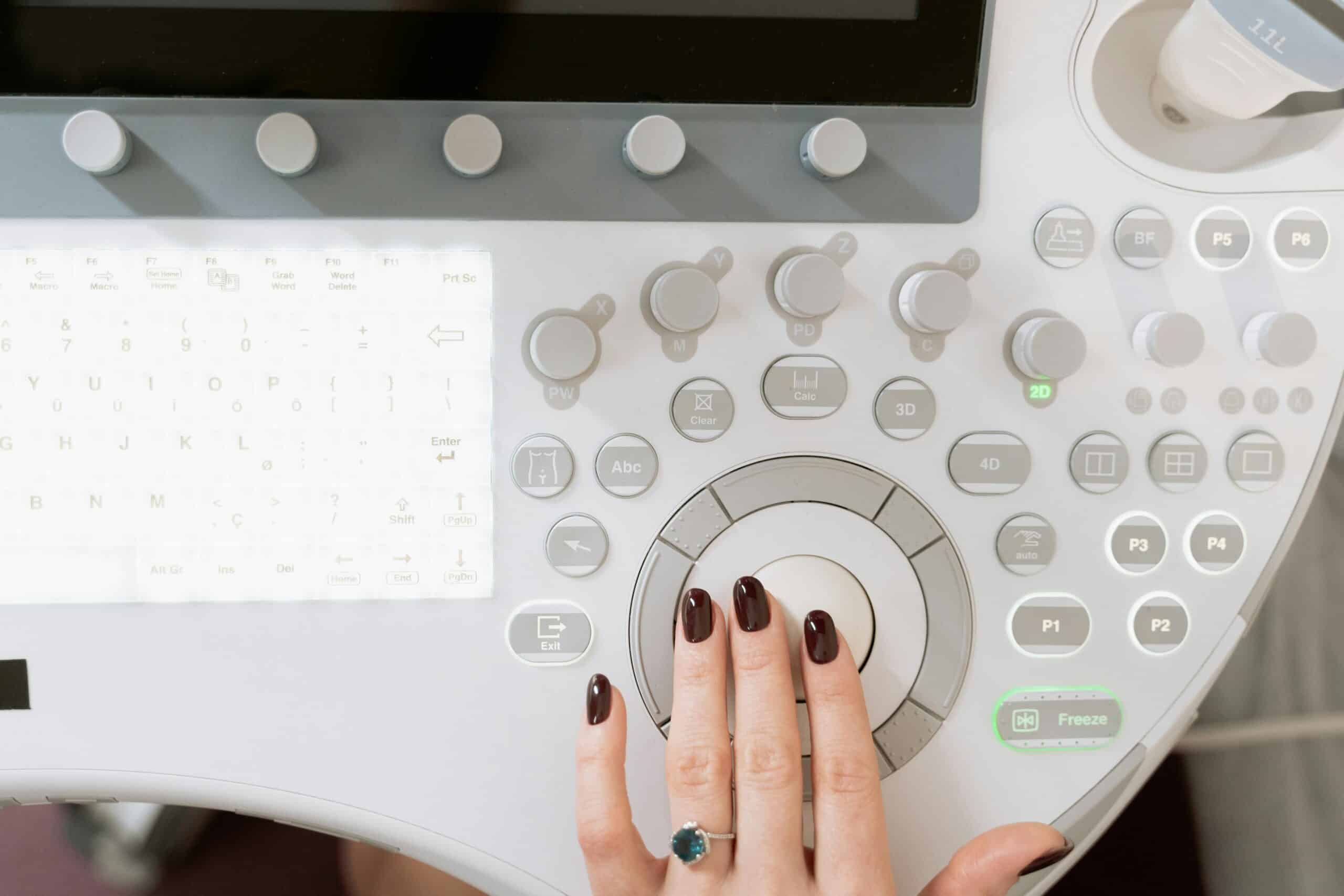 What to Expect in an Egg Freezing Ultrasound